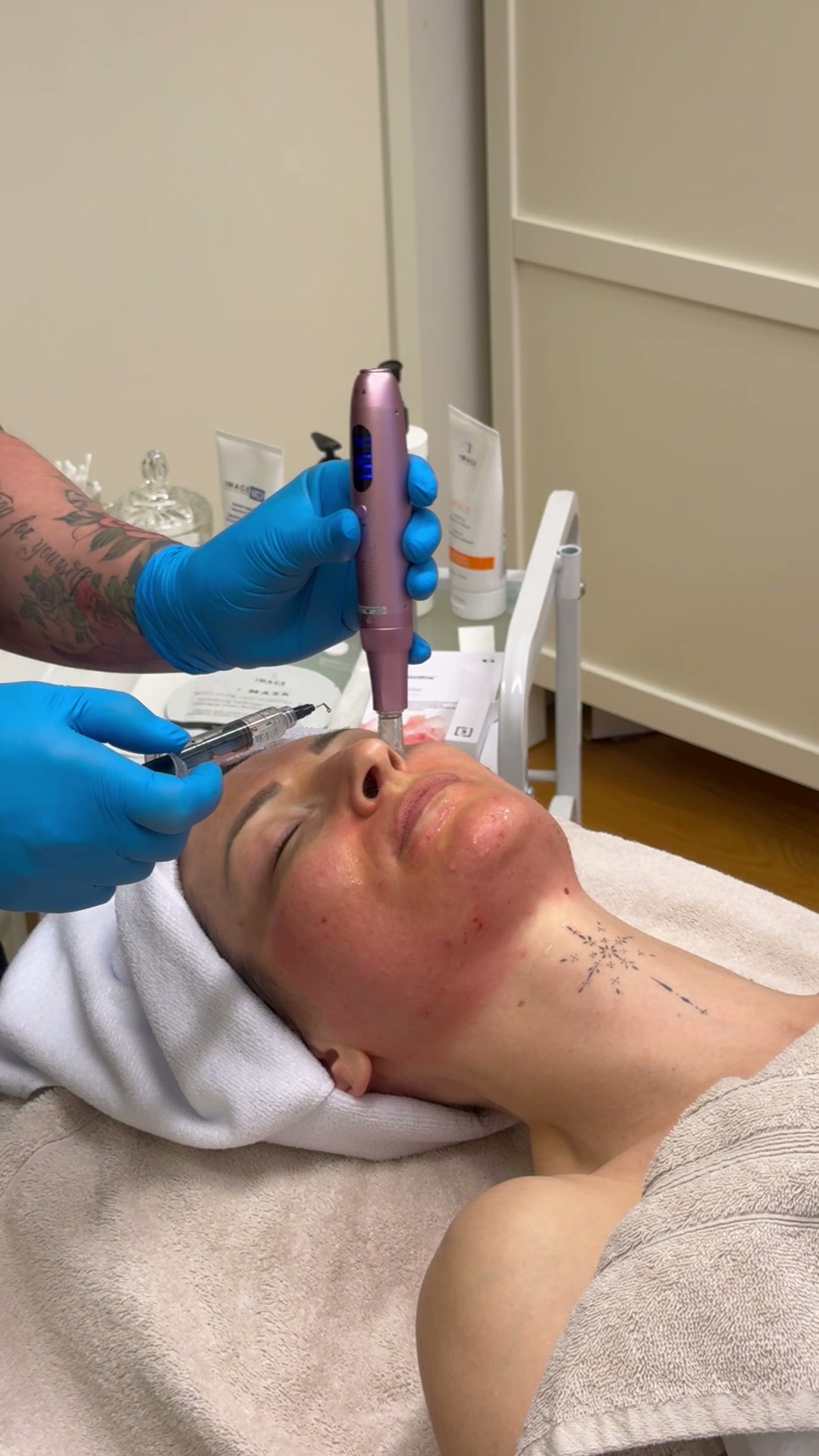Microneedling behandling